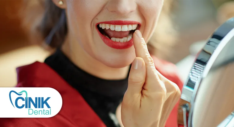 Composite bonding in Turkey