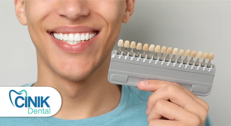 veneers cost in Turkey