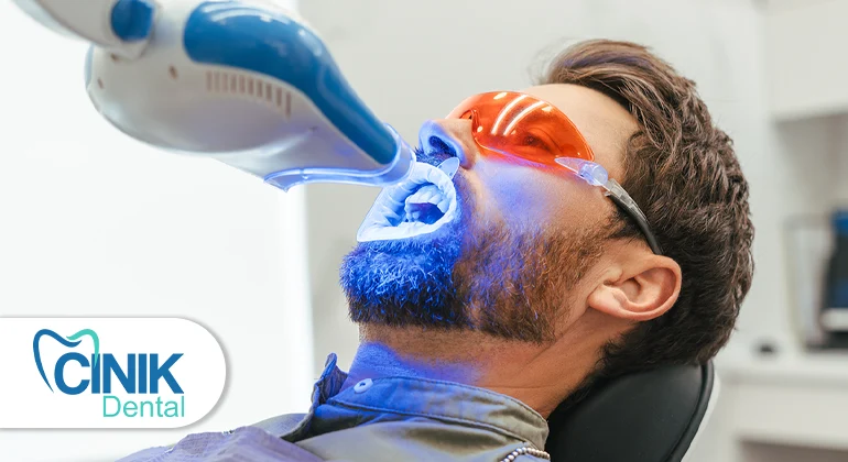 Teeth whitening in turkey cost