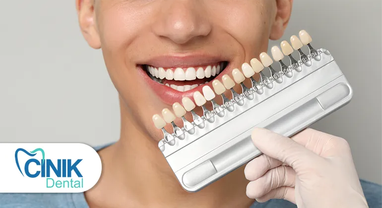 full mouth veneers cost