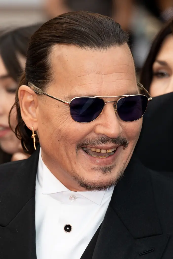 johnny depp's teeth before makeover