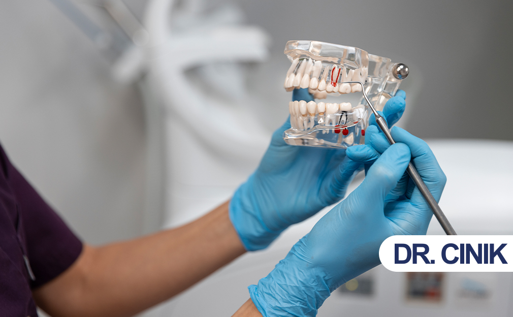 dental-implant-turkey