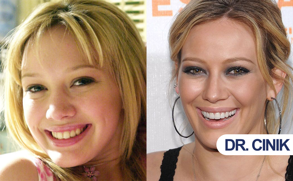 Hilary Duff